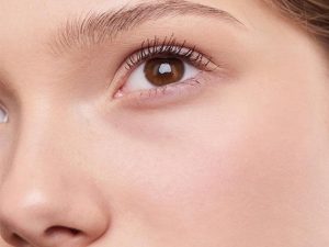 Benefits of radiofrequency pigmentation treatment